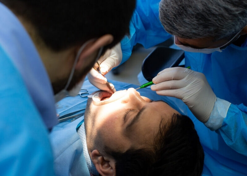 7 Signs You May Need a Root Canal Treatment