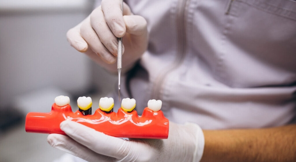Dental Implants: A Guide to the Procedure, Benefits and Care