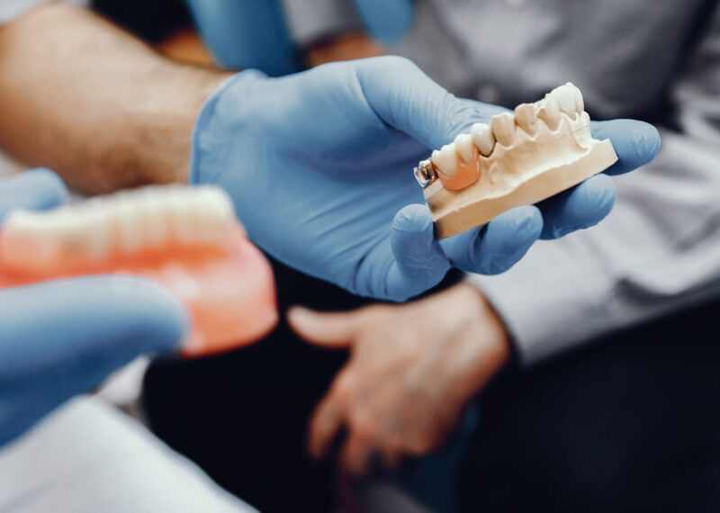 Dentures Explained: Types, Fit, and Same-Day Denture Options